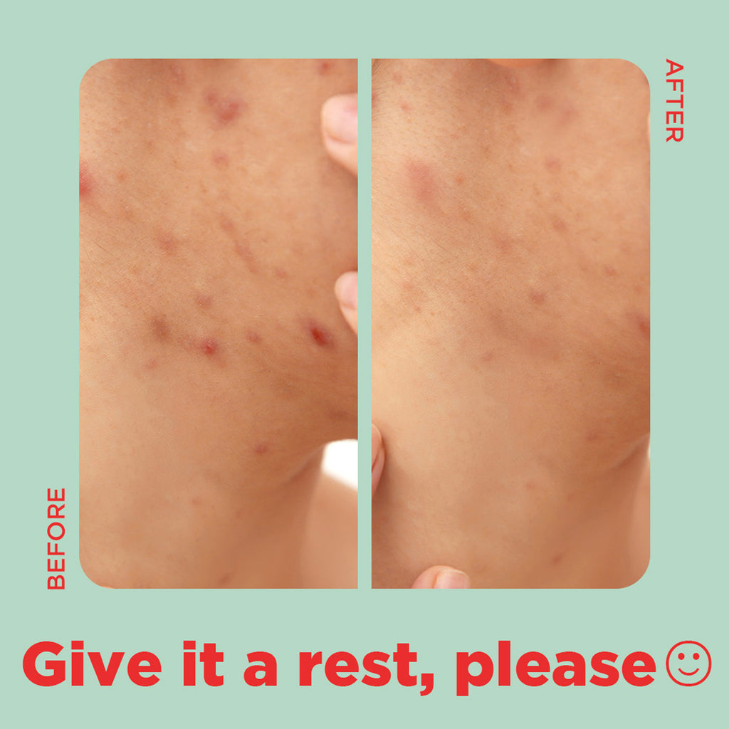 Tea Tree Clear Square Patch
