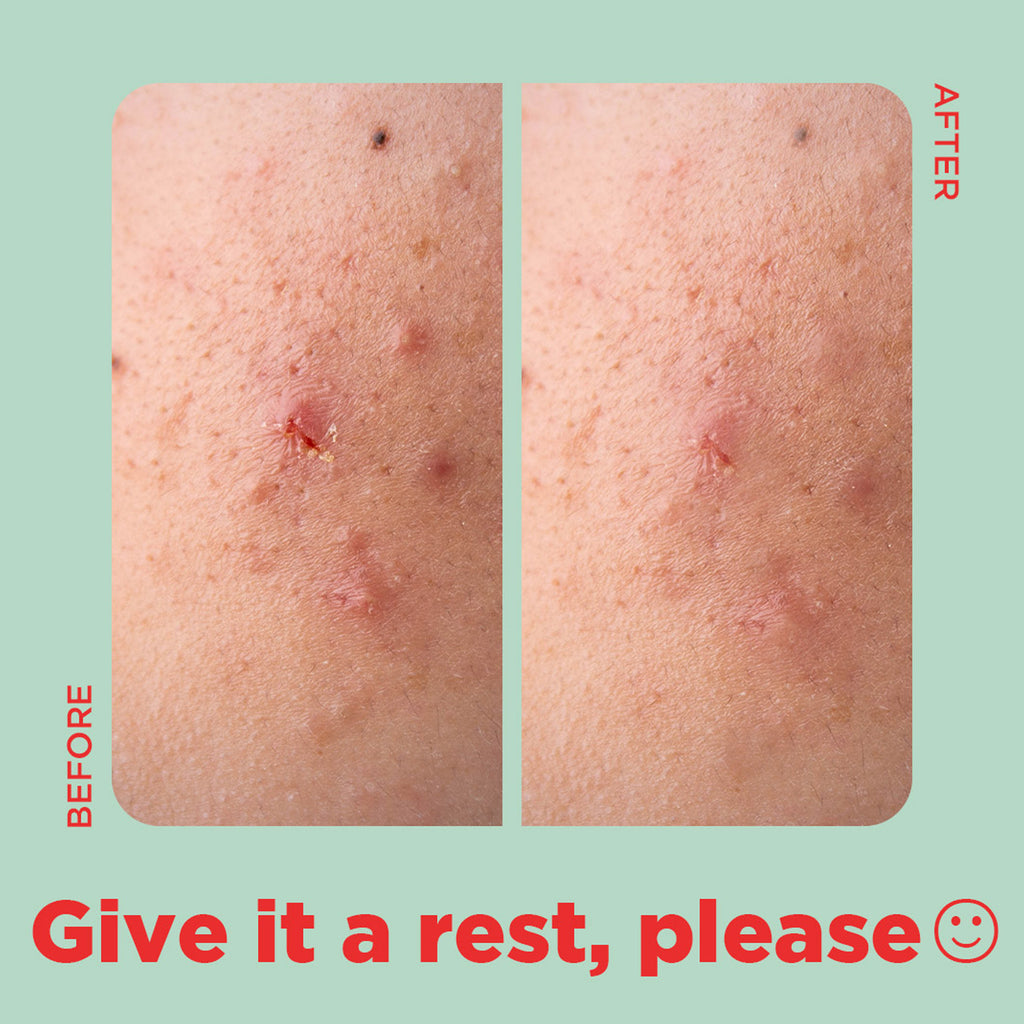 Tea Tree Clear Square Patch